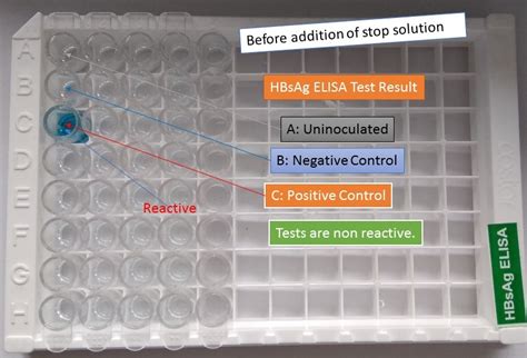 elisa test non reactive means|my elisa test report.